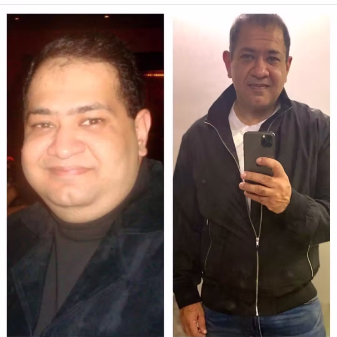 Transformation-3