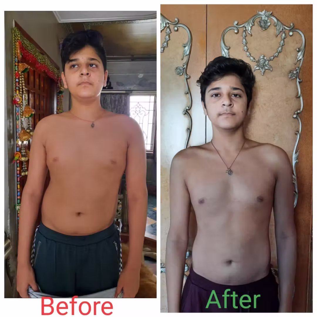 Transformation-5